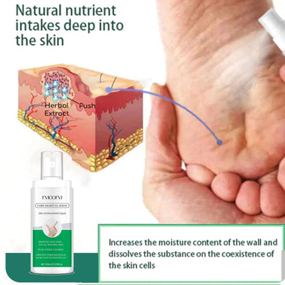 Corn Removal Spray 60ml Pack of 1