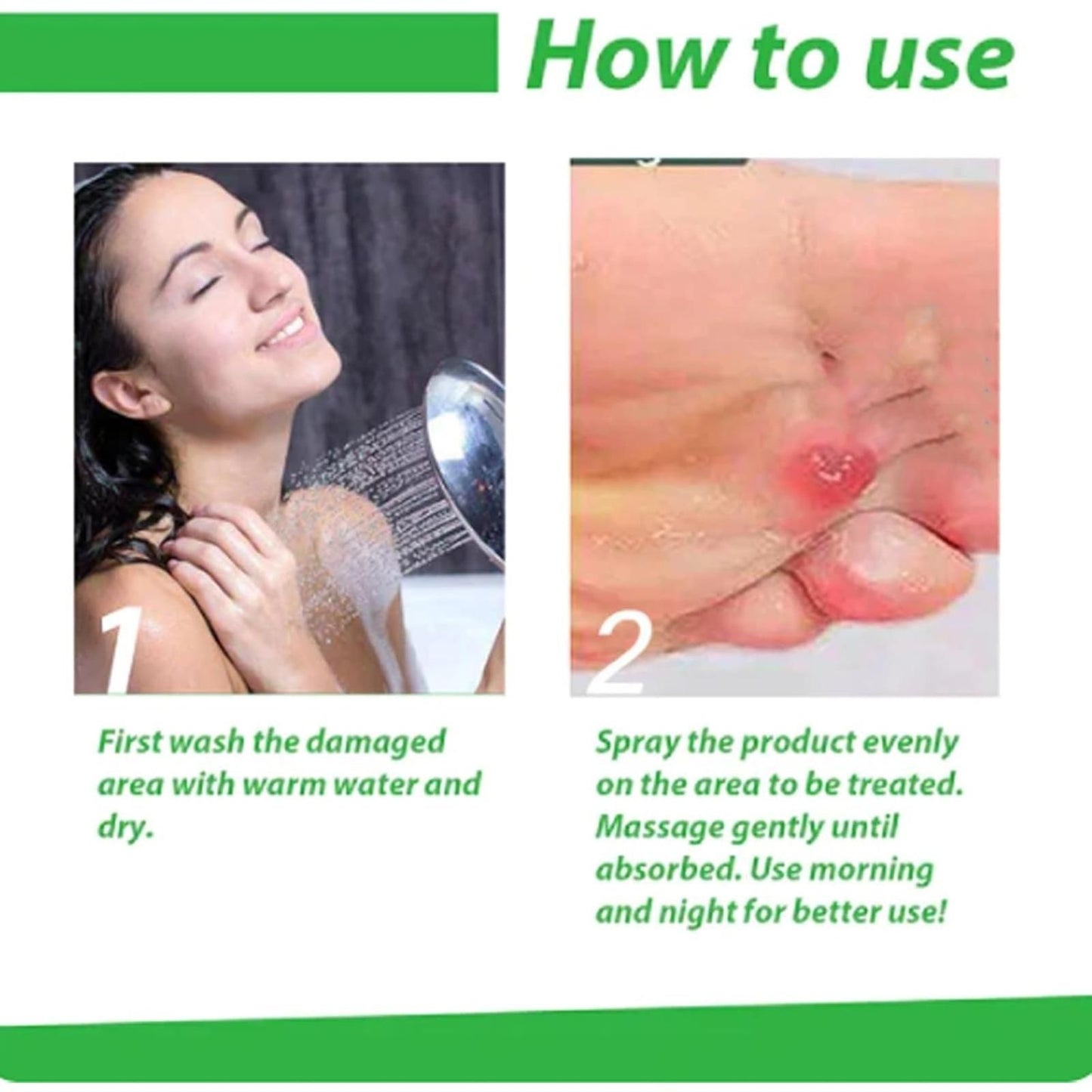 Corn Removal Spray 60ml Pack of 1