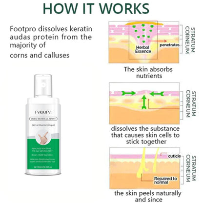 Corn Removal Spray 60ml Pack of 1